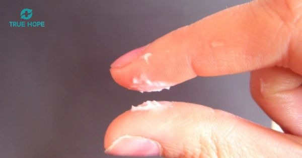 Các bệnh phụ khoa thường gặp