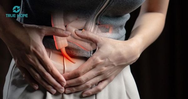 Viêm ruột thừa cấp