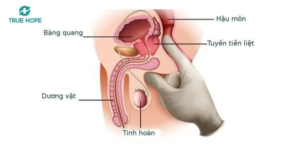 Tuyến tiền liệt