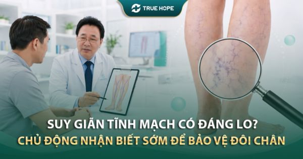 Suy giãn tĩnh mạch có đáng lo
