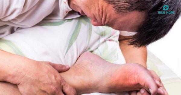 Đau buốt ngón chân khi ngủ dậy