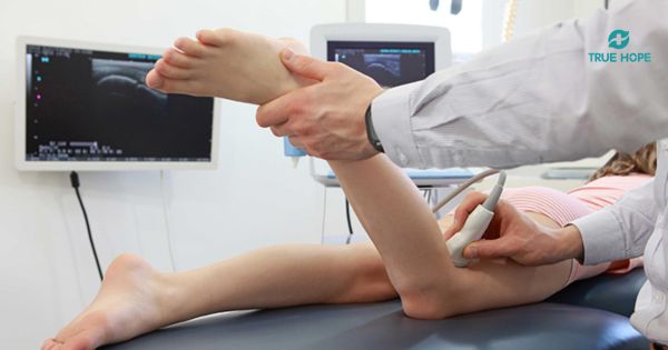 Siêu âm Doppler mạch máu đánh giá suy giãn tĩnh mạch