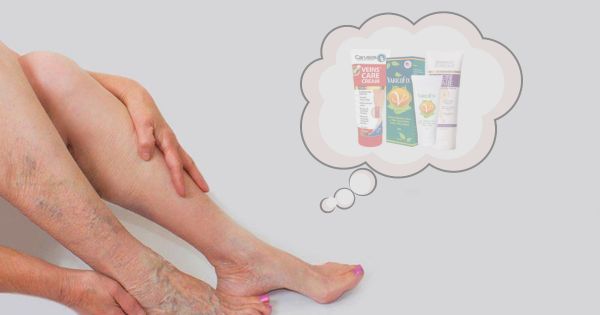 Tự bôi kem trị giãn mao mạch tĩnh mạch nhện tại nhà không thay thế được thăm khám chuyên khoa