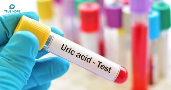 Xét nghiệm acid uric máu kiểm tra nguy cơ bệnh gout