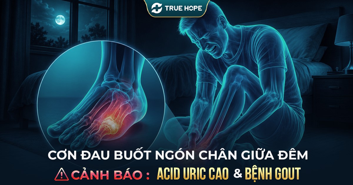 đau buốt ngón chân giữa đêm cảnh báo acid uric cao và bệnh gout