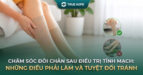 Chăm sóc đôi chân sau điều trị tĩnh mạch