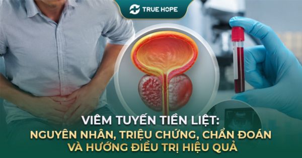 Viêm tuyến tiền liệt