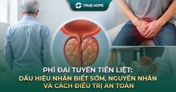Phì đại tuyến tiền liệt