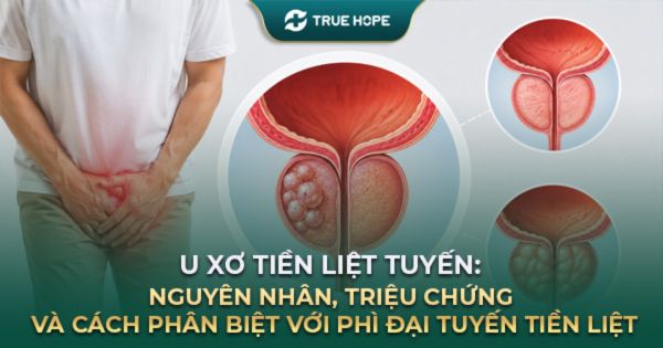 U xơ tiền liệt tuyến
