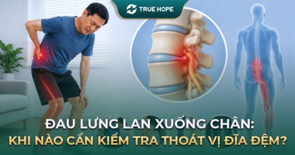 Đau lưng lan xuống chân: khi nào cần kiểm tra thoát vị đĩa đệm