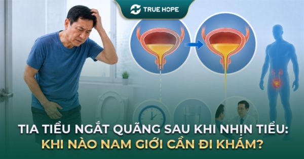 Tia tiểu ngắt quãng sau khi nhịn tiểu