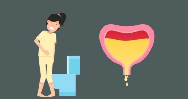 Phụ nữ sau sinh và mãn kinh dễ bị bàng quang tăng hoạt ban đêm