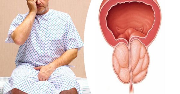Nam giới cần đi khám khi có dấu hiệu tiểu đêm từ 2 lần trở lên