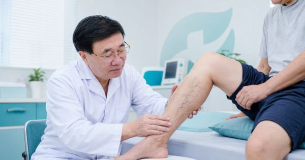 Bác sĩ khám và tư vấn suy giãn tĩnh mạch tại Phòng khám True Hope Hà Nội