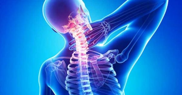 Đau cổ vai gáy kéo dài làm ngủ không sâu gây giảm tập trung ban ngày
