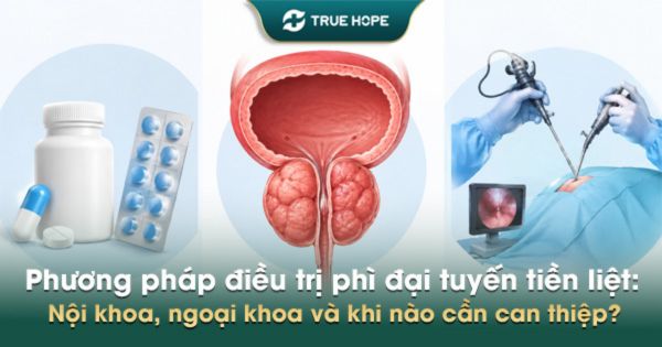 Phương pháp điều trị phì đại tuyến tiền liệt