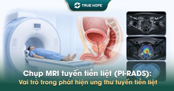 Chụp MRI tuyến tiền liệt (PI-RADS): Vai trò phát hiện ung thư