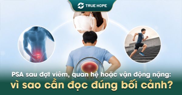 PSA sau đợt viêm, quan hệ hoặc vận động nặng