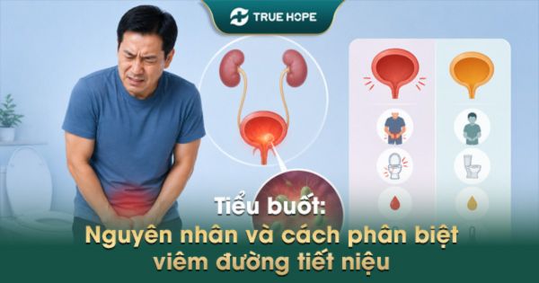 Tiểu buốt