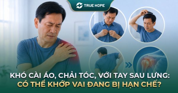 Khó cài áo chải tóc với tay sau lưng dấu hiệu khớp vai bị hạn chế vận động