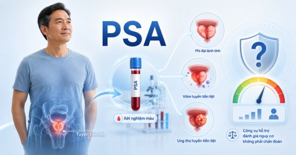 Xét nghiệm PSA bằng mẫu máu hỗ trợ giúp phát hiện bệnh lý liên quan đến tuyến tiền liệt