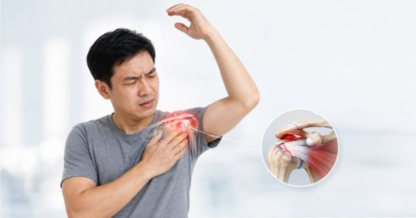 Đau vai khi giơ tay liên quan tổn thương gân chóp xoay viêm gân chèn ép