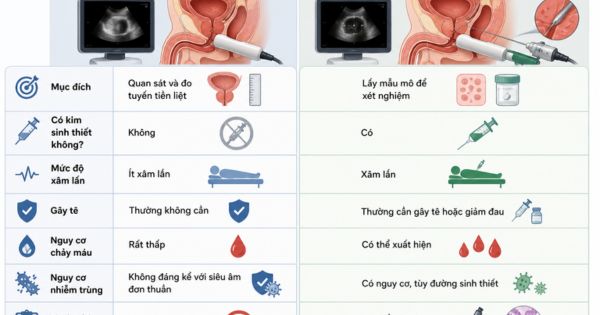 Phân biệt siêu âm TRUS và sinh thiết dưới hướng dẫn TRUS