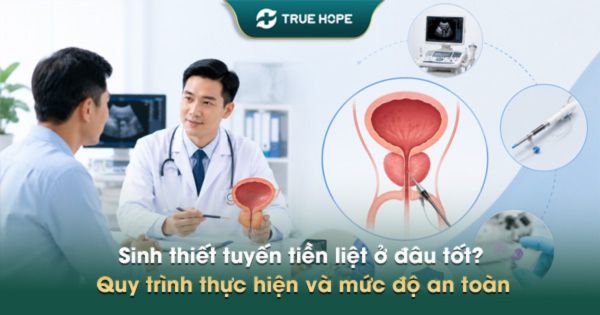 Sinh thiết tuyến tiền liệt ở đâu tốt? Quy trình thực hiện và mức độ an toàn
