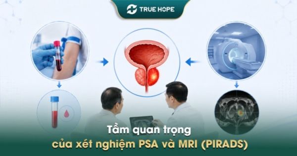 Tầm quan trọng của xét nghiệm PSA và MRI (PIRADS)