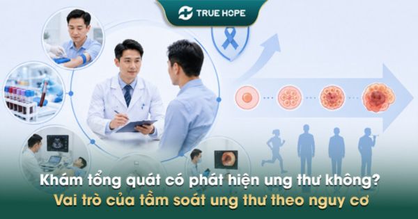Khám tổng quát có phát hiện ung thư không? Vai trò của tầm soát ung thư theo nguy cơ