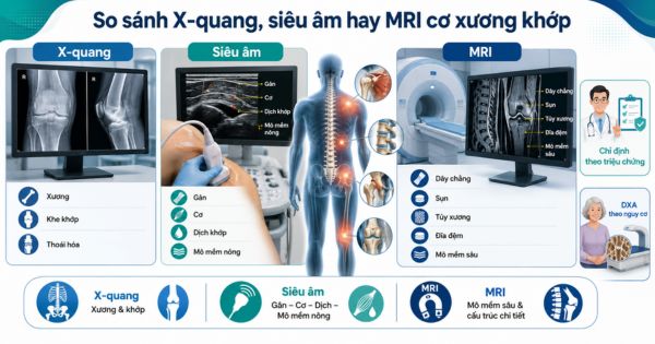 So sánh X-quang, siêu âm hay MRI cơ xương khớp