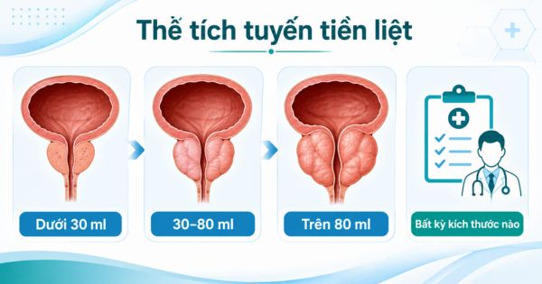 Thể tích tuyến tiền liệt có ý nghĩa đối với phẫu thuật