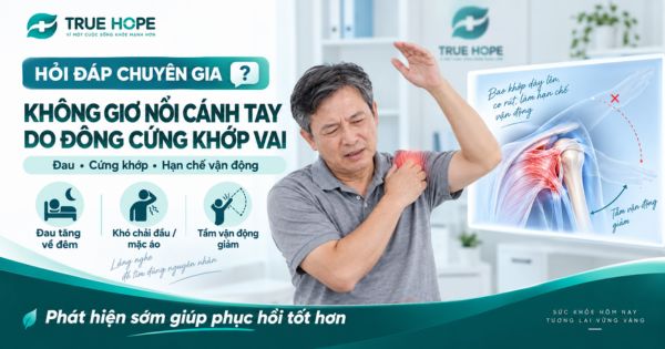 Không giơ nổi cánh tay do đông cứng khớp vai