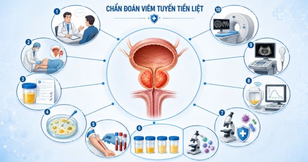 Các hạng mục chẩn đoán viêm tuyến tiền liệt