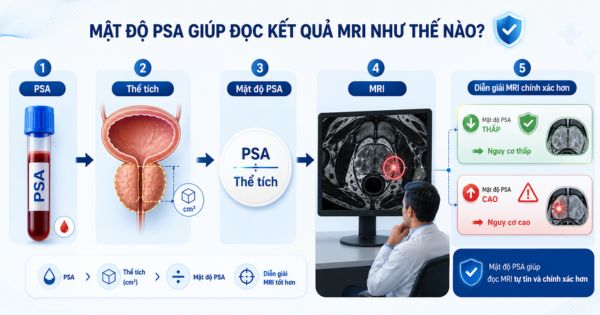 Mật độ PSA kết hợp thể tích tuyến tiền liệt giúp bác sĩ đánh giá kết quả MRI và nguy cơ tổn thương tuyến tiền liệt