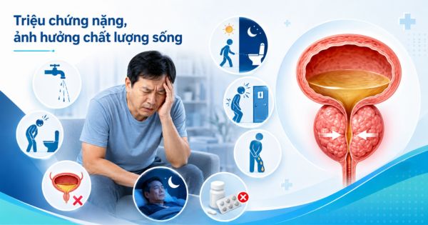 Tuyến tiền liệt to phải mổ do nhiễm khuẩn tiết niệu tái phát do triệu chứng nặng, ảnh hưởng rõ đến chất lượng sống