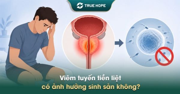 Viêm tuyến tiền liệt có ảnh hưởng sinh sản không