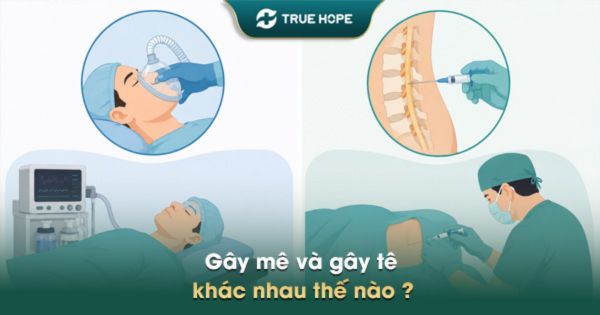 Gây mê và gây tê khác nhau thế nào