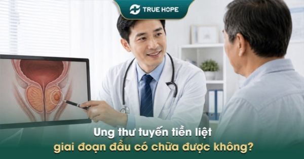 Ung thư tuyến tiền liệt giai đoạn đầu có chữa được không