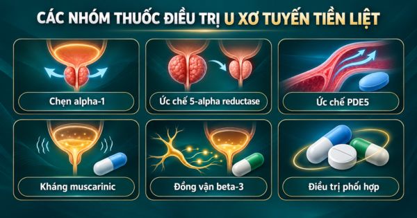 Các nhóm thuốc điều trị u xơ tiền liệt tuyến thường dùng