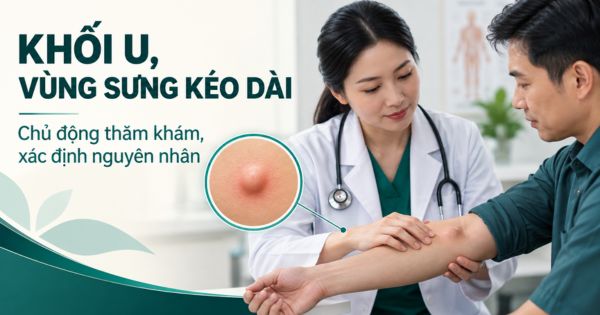 Có khối u hoặc vùng sưng bất thường kéo dài cần đi khám ngoại khoa