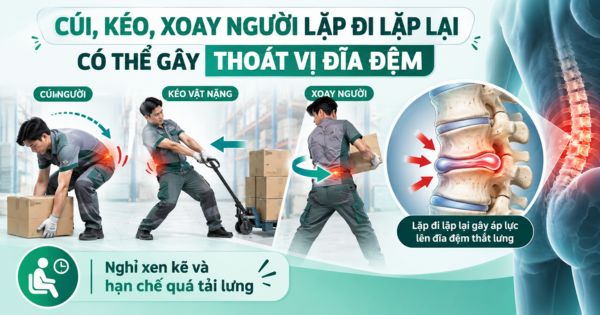 Thường xuyên cúi,kéo và xoay người lặp đi lặp lại có thể gây thoát vị đĩa đệm