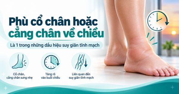Phù cổ chân hoặc cẳng chân về chiều là 1 trong những dấu hiệu suy giãn tĩnh mạch