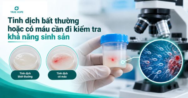 Tinh dịch bất thường hoặc có máu cần đi kiểm tra khả năng sinh sản