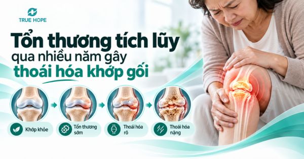 Tổn thương tích lũy qua nhiều năm gây thoái hóa khớp gối