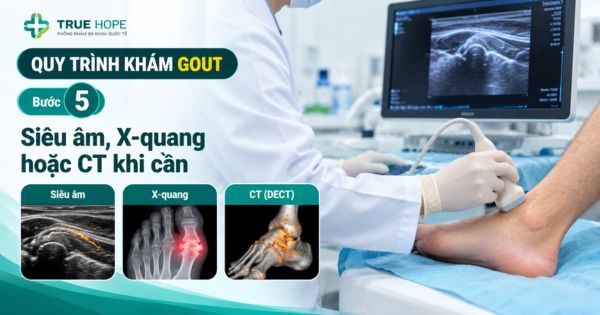 Quy trình khám gout - Siêu âm, X-quang hoặc CT
