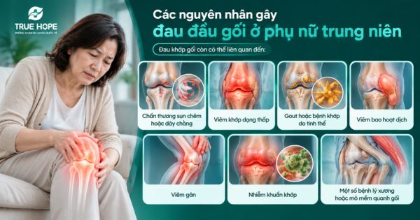 Các nguyên nhân gây đau đầu gối ở phụ nữ trung niên